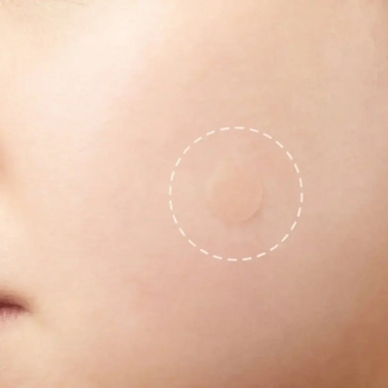 Adesivo para Acne